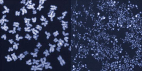 Menschliche Chromosomen im Mikroskop. Auf dem linken Bild sind die Chromosomen intakt, das rechte Bild zeigt kleingeschnittene Chromosomen aus Zellen, in denen das Enzym MUS81 unkontrolliert aktiv war.