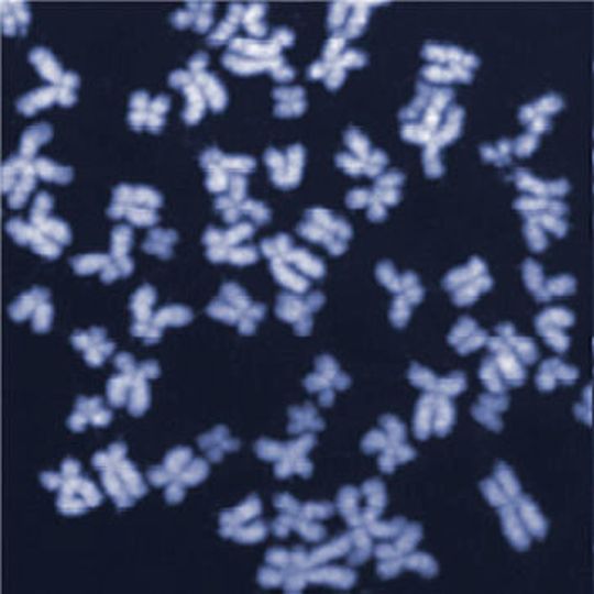 Menschliche Chromosomen im Mikroskop. Auf diesem Bild sind die Chromosomen intakt, .... (Ausschnitt) Menschliche Chromosomen im Mikroskop. Auf diesem Bild sind die Chromosomen intakt, .... (Ausschnitt)