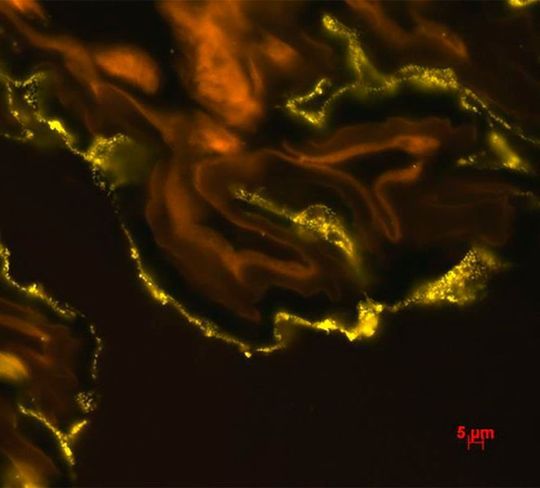 Die Fluoreszenz-in-situ-Hybridisierung (FISH) zeigt, dass bakterielle Enterococcus Zellen (gelb) in hoher Dichte an der Schleimschicht kleben, die die Darmwand überzieht. Die Fluoreszenz-in-situ-Hybridisierung (FISH) zeigt, dass bakterielle Enterococcus Zellen (gelb) in hoher Dichte an der Schleimschicht kleben, die die Darmwand überzieht.