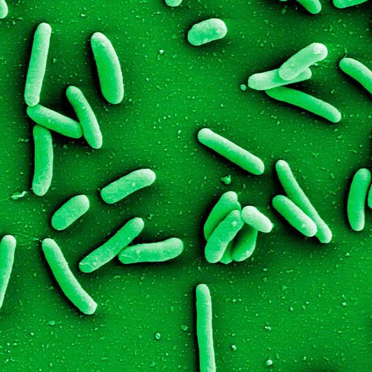 Die neue Software Traitar soll verschiedene Stämme des Erregers Pseudomonas aeruginosa auf neue Resistenzmechanismen gegen Antibiotika untersuchen Die neue Software Traitar soll verschiedene Stämme des Erregers Pseudomonas aeruginosa auf neue Resistenzmechanismen gegen Antibiotika untersuchen