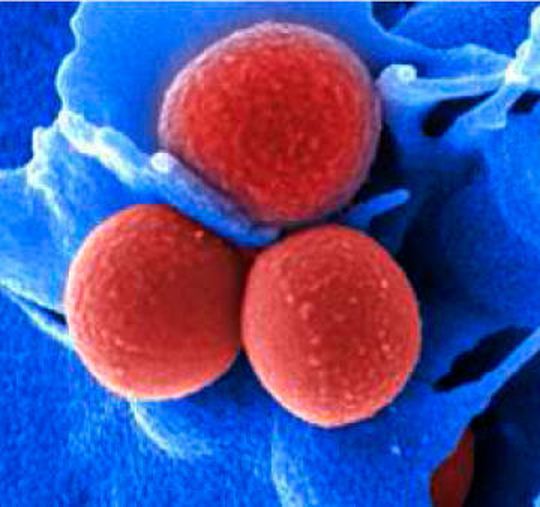 Elektronenmikroskopische Aufnahme von Staphylococcus aureus. Elektronenmikroskopische Aufnahme von Staphylococcus aureus.