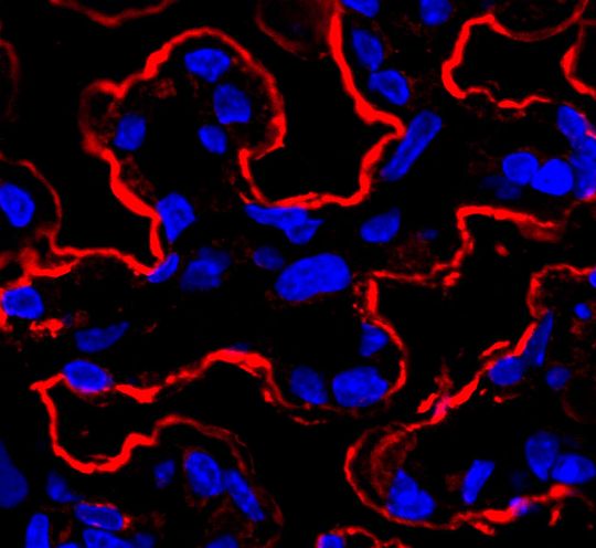 Das Protein Osteopontin (OPN) wird von Osteoblasten in der jungen Stammzellnische gebildet. Immunfluoreszenzfärbung des trabekulären Knochenmarks (OPN in rot). Osteoblasten (Zellkerne sind blau gefärbt, DAPI) finden sich nahe der Knochenmatrix und in einer Region, welche Endosteum genannt wird. Dort bilden sie eine Nische für blutbildende Stammzellen. Im Alter nimmt die Produktion von OPN von Osteoblasten stark ab. Das Protein Osteopontin (OPN) wird von Osteoblasten in der jungen Stammzellnische gebildet. Immunfluoreszenzfärbung des trabekulären Knochenmarks (OPN in rot). Osteoblasten (Zellkerne sind blau gefärbt, DAPI) finden sich nahe der Knochenmatrix und in einer Region, welche Endosteum genannt wird. Dort bilden sie eine Nische für blutbildende Stammzellen. Im Alter nimmt die Produktion von OPN von Osteoblasten stark ab.