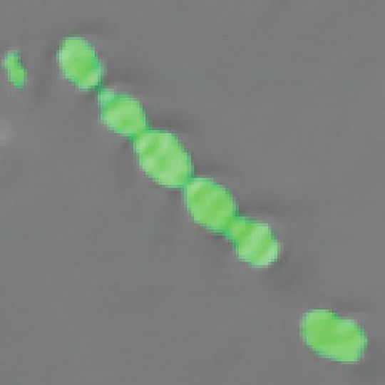 Unscheinbar, aber gefährlich: Das Bakterium Streptococcus pneumoniae kann und Lungen- und Hirnhautentzündung auslösen. Unscheinbar, aber gefährlich: Das Bakterium Streptococcus pneumoniae kann und Lungen- und Hirnhautentzündung auslösen.