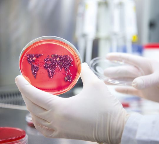 Zeitaufwändig: Bisher müssen Bakterien auf Nährboden gezüchtet werden, um Resistenzen zu erkennen. Spezielle Tests und Gendaten sollen schneller Gewissheit schaffen. Zeitaufwändig: Bisher müssen Bakterien auf Nährboden gezüchtet werden, um Resistenzen zu erkennen. Spezielle Tests und Gendaten sollen schneller Gewissheit schaffen.