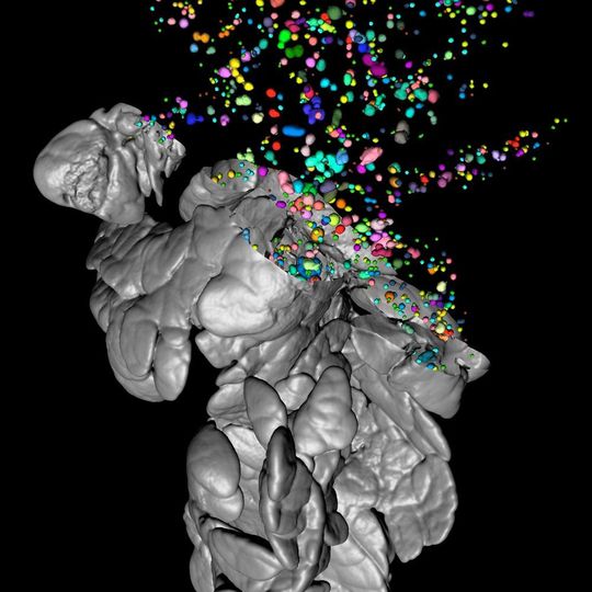 The image, created with OPT, shows the pancreas of a healthy mouse. The individual pancreatic islets have been color-coded and their exact volume and 3D-coordinates can be precisely determined throughout the pancreas. The exocrine pancreatic tissue (in grey) has partly been digitally removed. The image, created with OPT, shows the pancreas of a healthy mouse. The individual pancreatic islets have been color-coded and their exact volume and 3D-coordinates can be precisely determined throughout the pancreas. The exocrine pancreatic tissue (in grey) has partly been digitally removed.