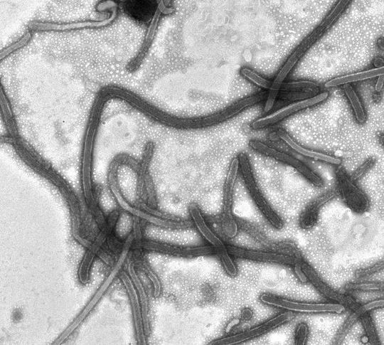 Mikroskopaufnahme von Ebola-Viren Mikroskopaufnahme von Ebola-Viren