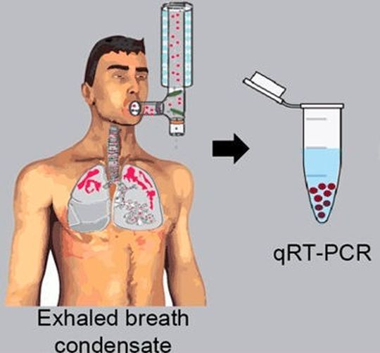 Das Lungengewebe gibt RNA-Moleküle an die Atemluft ab, die aufgefangen und mittels einer Polymerase-Kettenreaktion (qRT-PCR) vervielfältigt werden können. Das Lungengewebe gibt RNA-Moleküle an die Atemluft ab, die aufgefangen und mittels einer Polymerase-Kettenreaktion (qRT-PCR) vervielfältigt werden können.