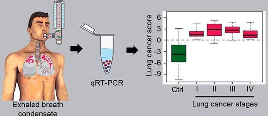 Das Lungengewebe gibt RNA-Moleküle an die Atemluft ab, die aufgefangen und mittels einer Polymerase-Kettenreaktion (qRT-PCR) vervielfältigt werden können. Anhand der unterschiedlichen Mengen abgegebener RNA-Moleküle lassen sich Krebszellen in der Lunge aufspüren. Das Lungengewebe gibt RNA-Moleküle an die Atemluft ab, die aufgefangen und mittels einer Polymerase-Kettenreaktion (qRT-PCR) vervielfältigt werden können. Anhand der unterschiedlichen Mengen abgegebener RNA-Moleküle lassen sich Krebszellen in der Lunge aufspüren.