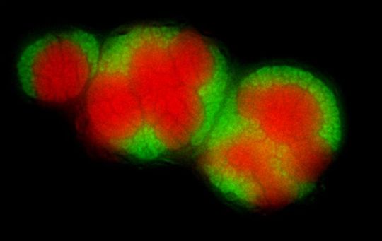 Archaeen (rot) und Bakterien (grün) bilden ein Konsortium zur Methanoxidation. Die Proben stammen aus Tiefseesedimenten vor der Küste Kaliforniens, Monterey Bay nach Fluoreszenz-in-situ-Hybridisierung (CARD-FISH). (Quelle: Annelie Pernthaler/UFZ) Archaeen (rot) und Bakterien (grün) bilden ein Konsortium zur Methanoxidation. Die Proben stammen aus Tiefseesedimenten vor der Küste Kaliforniens, Monterey Bay nach Fluoreszenz-in-situ-Hybridisierung (CARD-FISH). (Quelle: Annelie Pernthaler/UFZ)