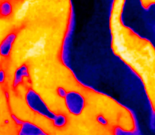Spezielle Röntgenaufnahme eines Knochens: Die Farben geben Auskunft über die Verteilung verschiedener chemischer Elemente. Spezielle Röntgenaufnahme eines Knochens: Die Farben geben Auskunft über die Verteilung verschiedener chemischer Elemente.