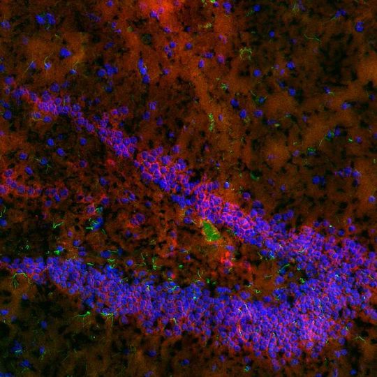 Ein Teil der Gehirnstruktur Hippocampus mit fluoreszierendem Endocannabinoid-System in Nervenzellen. Ein Teil der Gehirnstruktur Hippocampus mit fluoreszierendem Endocannabinoid-System in Nervenzellen.