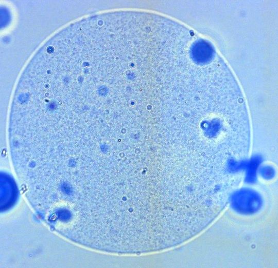 Eine Mikrokapsel ist mit rund 20 000 probiotischen Keimen gefüllt, die erst im Darm die schützende Hülle verlassen. Eine Mikrokapsel ist mit rund 20 000 probiotischen Keimen gefüllt, die erst im Darm die schützende Hülle verlassen.