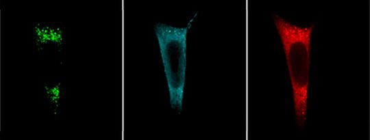 Menschliche Zellen exprimieren zwei interagierende Proteine (in grün und blau), aufgenommen mit Konfokalmikroskopie. Die „split-BioID“-Methode markiert zusätzliche Proteine, die zu demselben Komplex gehören (in rot).