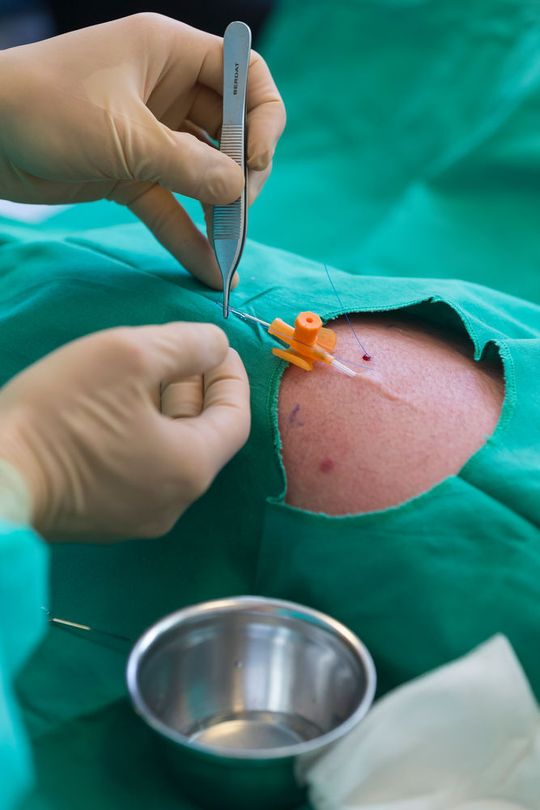 Mit einem neuen Impfprodukt wollen das private Biotech-Unternehmen Maxivax und die Universitätsspitäler Genf wollen mit einem neuen Impfprodukt das Immunsystem von Krebspatienten gegen die eigenen Tumorzellen stärken. Mit einem neuen Impfprodukt wollen das private Biotech-Unternehmen Maxivax und die Universitätsspitäler Genf wollen mit einem neuen Impfprodukt das Immunsystem von Krebspatienten gegen die eigenen Tumorzellen stärken.