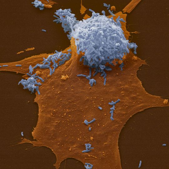 Der Erreger Bartonella henselae Der Erreger Bartonella henselae