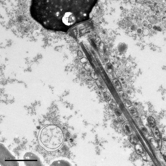 Die EM-Aufnahme zeigt ein Spermium mit angelagertem Amyloid. Die EM-Aufnahme zeigt ein Spermium mit angelagertem Amyloid.