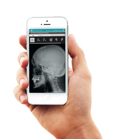 Health Data Space stellt Start-ups und Forschungsgruppen ein kostenloses Entwicklungs-Toolkit für Gesundheits-Apps zur Verfügung. Health Data Space stellt Start-ups und Forschungsgruppen ein kostenloses Entwicklungs-Toolkit für Gesundheits-Apps zur Verfügung.