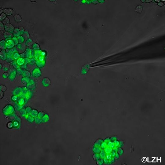 Bei der Optogenetik werden Zellen durch Licht gezielt verändert. Hier zu sehen: eine neuronale Zelllinie. Bei der Optogenetik werden Zellen durch Licht gezielt verändert. Hier zu sehen: eine neuronale Zelllinie.