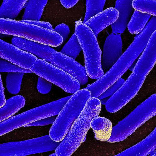 Colorized scanning electron micrograph of Escherichia coli, grown in culture and adhered to a cover slip. Colorized scanning electron micrograph of Escherichia coli, grown in culture and adhered to a cover slip.