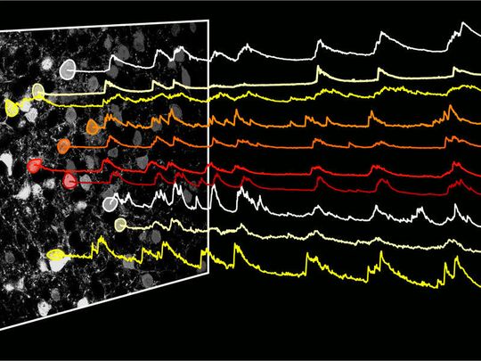 Nervenzellen vom Typ HTR2a in der Amygdala der Maus sind während des Essens aktiv (Ausschläge in den Aktivitätskurven), wodurch die Nahrungsaufnahme gefördert wird. Die Aktivitätskurven einzelner Nervenzellen sind in verschiedenen Farben dargestellt.