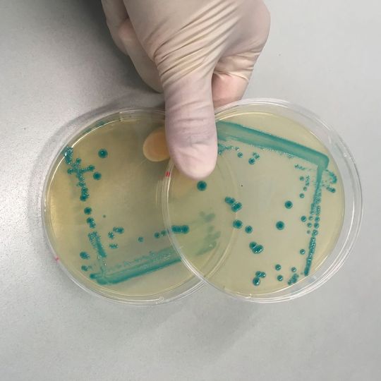 Listerien sind Überlebenskünstler, den Hygienemaßnahmen in der Lebensmittelproduktion entkommen sie etwa dank einer nun identifizierten, genetischen „Stressinsel“. Listerien sind Überlebenskünstler, den Hygienemaßnahmen in der Lebensmittelproduktion entkommen sie etwa dank einer nun identifizierten, genetischen „Stressinsel“.