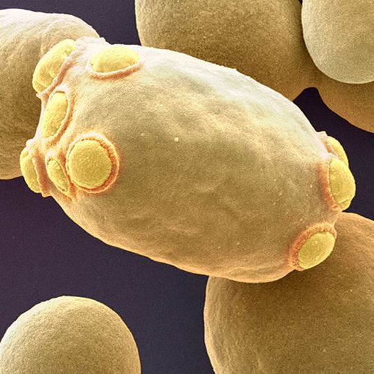 Die Bäckerhefe Saccharomyces cerevisiae. Die Bäckerhefe Saccharomyces cerevisiae.