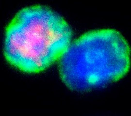 T-Zellen unter Kontrollbedingungen. Immunfluoreszenzfärbung von T-Zellen (grün: T-Zellmarker CD3, rot: Treg-Marker Foxp3, blau: Zellkern) (Ausschnitt) ... T-Zellen unter Kontrollbedingungen. Immunfluoreszenzfärbung von T-Zellen (grün: T-Zellmarker CD3, rot: Treg-Marker Foxp3, blau: Zellkern) (Ausschnitt) ...