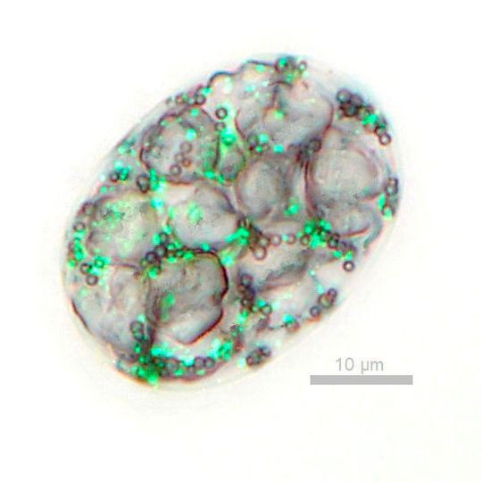 Zelle des Bakteriums Achromatium oxaliferum unter dem Mikroskop. Man erkennt große Calciumkristalle, Schwefeltröpfchen sowie grün fluoreszierende DNA-Spots. Zelle des Bakteriums Achromatium oxaliferum unter dem Mikroskop. Man erkennt große Calciumkristalle, Schwefeltröpfchen sowie grün fluoreszierende DNA-Spots.