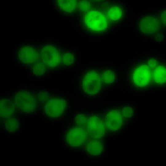 Hefezellen ohne Proteinaggregate Hefezellen ohne Proteinaggregate