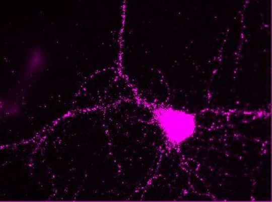 Fluoreszenzbild einer Nervenzelle aus dem Hippocampus. In Magenta ist das aktivierte intrazelluläre Adapterprotein Dab1des Reelin-Signalweges dargestellt, das für die Gehirnreifung entscheidend ist. Fluoreszenzbild einer Nervenzelle aus dem Hippocampus. In Magenta ist das aktivierte intrazelluläre Adapterprotein Dab1des Reelin-Signalweges dargestellt, das für die Gehirnreifung entscheidend ist.
