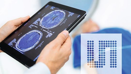 Hochaufgelöste CT-Bilder sind dank des geringen Rauschens des Sensor-Interfaces möglich. Hochaufgelöste CT-Bilder sind dank des geringen Rauschens des Sensor-Interfaces möglich.