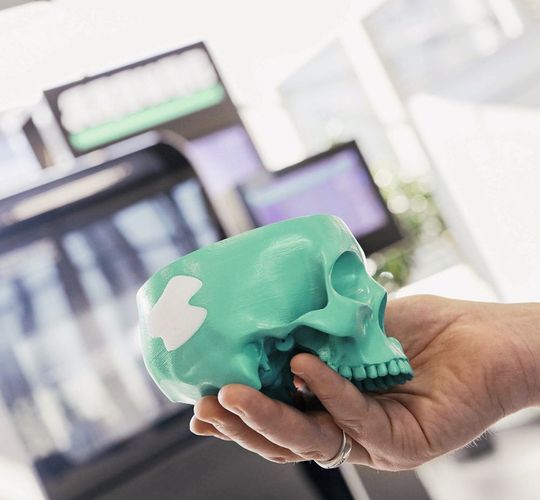 Abb.1: Ein wichtiges Anwendungsgebiet der additiven Fertigung sind individuell angepasste Implantate und Orthesen. Das medizinische PLA (Polylactid), das sich langsam im Körper abbaut, kann aktuell nur vom Freeformer verarbeitet werden. Abb.1: Ein wichtiges Anwendungsgebiet der additiven Fertigung sind individuell angepasste Implantate und Orthesen. Das medizinische PLA (Polylactid), das sich langsam im Körper abbaut, kann aktuell nur vom Freeformer verarbeitet werden.