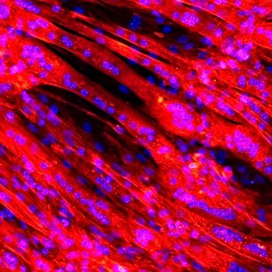 Der Natur nachgeahmt: Ein Geflecht aus Muskelfasern wächst auf einem Gerüst auf gesponnenem Kunststoff. Unter dem konfokalen Laser-Scanning-Mikroskop erscheinen Muskelfasern rot und Zellkerne blau. Der Natur nachgeahmt: Ein Geflecht aus Muskelfasern wächst auf einem Gerüst auf gesponnenem Kunststoff. Unter dem konfokalen Laser-Scanning-Mikroskop erscheinen Muskelfasern rot und Zellkerne blau.