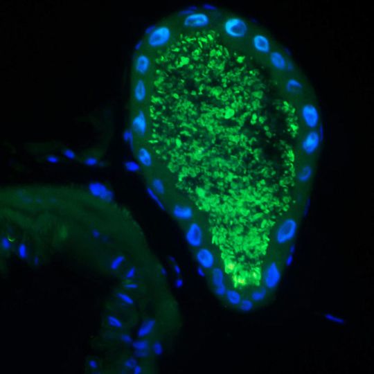 Dank winziger Bakterien in speziellen Organen an seinem Darm, kann der Käfer pflanzliche Nahrung verdauen. Der Querschnitt zeigt die symbiotischen Organe im Käferdarm. In diesen sackartigen Ausstülpungen leben die Symbiose-Bakterien. Dank winziger Bakterien in speziellen Organen an seinem Darm, kann der Käfer pflanzliche Nahrung verdauen. Der Querschnitt zeigt die symbiotischen Organe im Käferdarm. In diesen sackartigen Ausstülpungen leben die Symbiose-Bakterien.