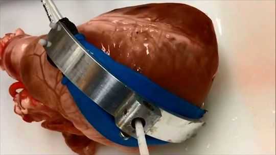 Softroboter an schlagendem Schweineherz. Mit der an der Herzscheidewand verankerten Robotik kann eine kranke Herzkammer von Außen unterstützt werden. Softroboter an schlagendem Schweineherz. Mit der an der Herzscheidewand verankerten Robotik kann eine kranke Herzkammer von Außen unterstützt werden.