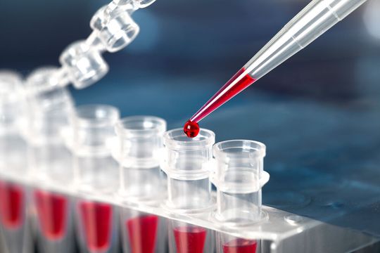 Bei den Tests von Fast Track Diagnostics handelt es sich um Real-Time-PCR(Polymerase- Kettenreaktion)-Kits, die sowohl Singleplex- als auch syndromisches Testen ermöglichen. Bei den Tests von Fast Track Diagnostics handelt es sich um Real-Time-PCR(Polymerase- Kettenreaktion)-Kits, die sowohl Singleplex- als auch syndromisches Testen ermöglichen.
