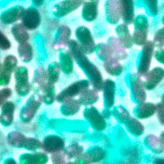 Bakterieller Konkurrenzkampf im Mikrobereich: Die durch das T6SS (grün, violett) vermittelte Abtötung und Auflösung konkurrierender Bakterien kann zur DNA-Freisetzung (türkis) und anschließendem Genaustausch führen. Bakterieller Konkurrenzkampf im Mikrobereich: Die durch das T6SS (grün, violett) vermittelte Abtötung und Auflösung konkurrierender Bakterien kann zur DNA-Freisetzung (türkis) und anschließendem Genaustausch führen.