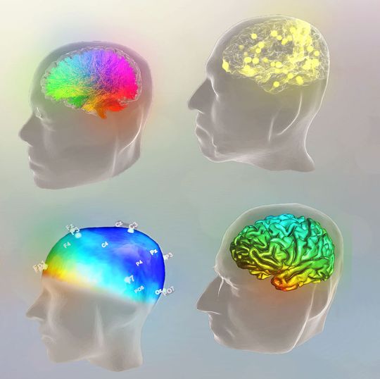 The Virtual Brain ist eine Open-source-Software zur personalisierten Simulation von Gehirnen. The Virtual Brain ist eine Open-source-Software zur personalisierten Simulation von Gehirnen.