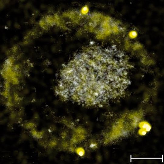 Das Bakterium C. metallidurans bildet winzig kleine Goldnuggets. Das Bakterium C. metallidurans bildet winzig kleine Goldnuggets.