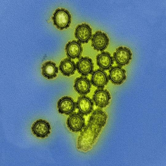 Particles of the H1N1 influenza virus. Particles of the H1N1 influenza virus.