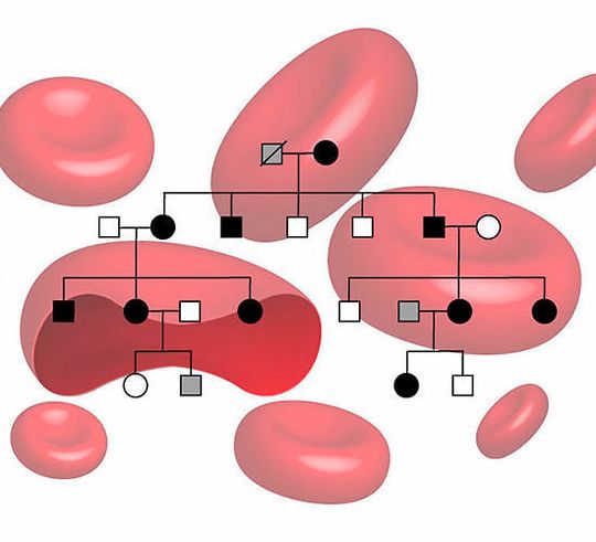 Erbgang der familiären Erythrozytose. Die Erkrankung führt zu einer erhöhten Produktion von körpereigenem Erythropoetin (EPO) im Blut. Erbgang der familiären Erythrozytose. Die Erkrankung führt zu einer erhöhten Produktion von körpereigenem Erythropoetin (EPO) im Blut.