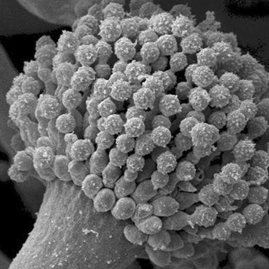 Elektronenmikroskopische Aufnahme des Schimmelpilzes Aspergillus fumigatus. A. fumigatus ist allgegenwärtig. Obwohl er für gesunde Menschen ungefährlich ist, kann er lebensbedrohliche Lungeninfektionen in stark immungeschwächten Patienten verursachen. Daneben kann der Pilz auch für allergische Krankheitssymptome verantwortlich sein. Elektronenmikroskopische Aufnahme des Schimmelpilzes Aspergillus fumigatus. A. fumigatus ist allgegenwärtig. Obwohl er für gesunde Menschen ungefährlich ist, kann er lebensbedrohliche Lungeninfektionen in stark immungeschwächten Patienten verursachen. Daneben kann der Pilz auch für allergische Krankheitssymptome verantwortlich sein.