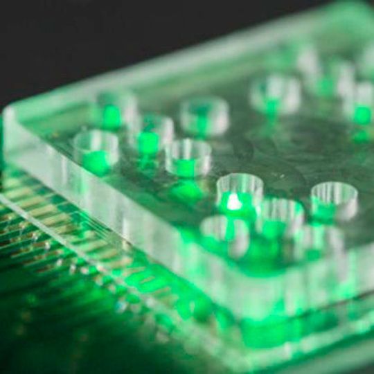 Ein briefmarkengroßer Chip ist das Kernstück des neuen Schnelltests zur Analyse von Antibiotikaresistenzen bei Keimen. Ein briefmarkengroßer Chip ist das Kernstück des neuen Schnelltests zur Analyse von Antibiotikaresistenzen bei Keimen.