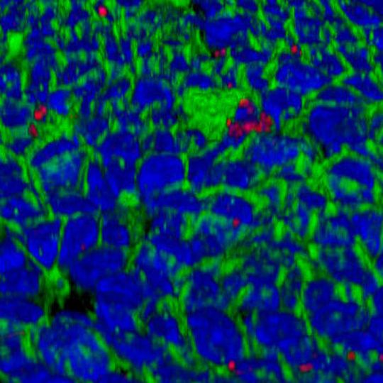 Oberfläche eines mit Helicobacter infizierten so genannten Mukosoids aus menschlichen Magenschleimhautzellen (rot: Helicobacter pylori, blau: Zellkerne, grün: Zellmembrane). (Ausschnitt, klicken für Großansicht) Oberfläche eines mit Helicobacter infizierten so genannten Mukosoids aus menschlichen Magenschleimhautzellen (rot: Helicobacter pylori, blau: Zellkerne, grün: Zellmembrane). (Ausschnitt, klicken für Großansicht)