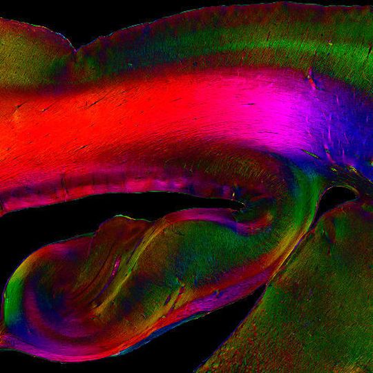 Der Hippocampus, ist eine der in besonders viele Funktionen involvierten Regionen des Gehirns. In diesem bildausschnitt ist seine Struktur sichtbar gemacht mit dem in Jülich und Düsseldorf entwickelten Verfahren PLI (Polarized Light Imaging). Der Hippocampus, ist eine der in besonders viele Funktionen involvierten Regionen des Gehirns. In diesem bildausschnitt ist seine Struktur sichtbar gemacht mit dem in Jülich und Düsseldorf entwickelten Verfahren PLI (Polarized Light Imaging).