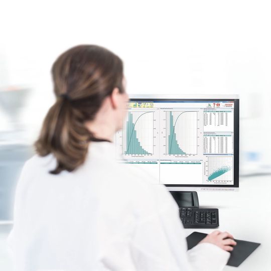 Abb.1: Die Analysette 28 kann Partikelformen und -größen im Bereich von 20 µm bis 20 mm messen. Abb.1: Die Analysette 28 kann Partikelformen und -größen im Bereich von 20 µm bis 20 mm messen.