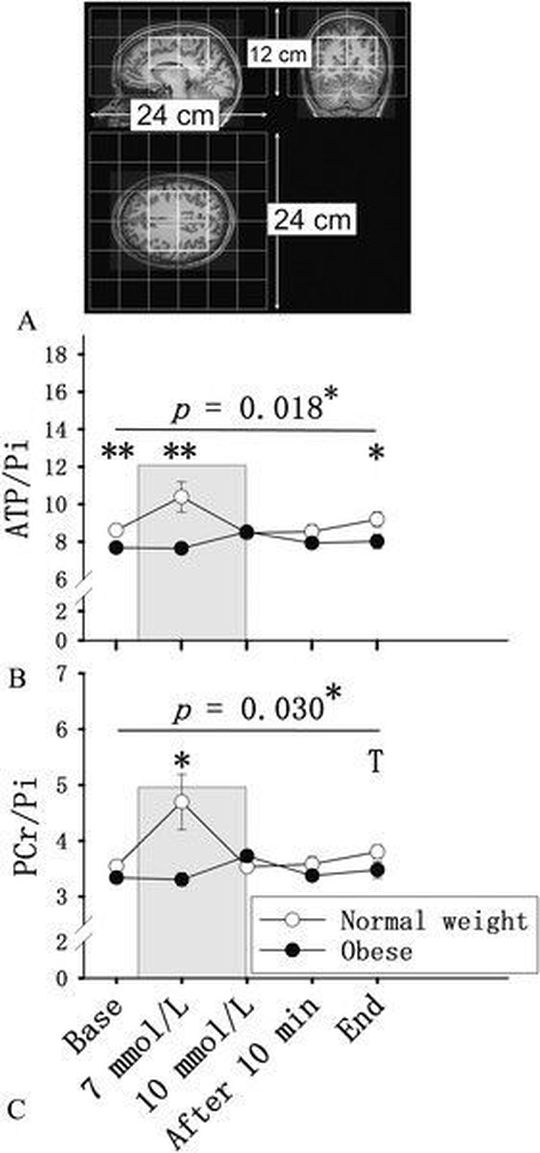 Zielregion der 31P-MRS-Messungen im Gehirn (sagittal, coronal, transversal (A). Mittelwerte ± Standardfehler der Quotienten aus Adenosintriphosphat (B) und Phosphocreatin (C) zu anorganischem Phosphat bei adipösen (schwarze Kreise) und normalgewichtigen (weiße Kreise) Studienteilnehmern. Das graue Feld markiert die intravenöse Gabe von 20%iger Glukose. Die Daten wurden mittels zweifaktorieller ANOVA inkl. Bonferroni-Korrektur sowie ungepaarten Student t-Tests für Gruppenvergleiche analysiert. Angezeigt wird der Interaktionseffekt zwischen den Faktoren Gruppe (adipös, Kontrolle) und Zeit. Tp < 0.1; *p < 0.05; **p < 0.01. (Quelle: )