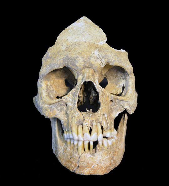 Skeletal remains of HBV positive individual from the Stone Age site of Karsdorf, Germany, it is from a male with an age at death of around 25-30 years. Skeletal remains of HBV positive individual from the Stone Age site of Karsdorf, Germany, it is from a male with an age at death of around 25-30 years.