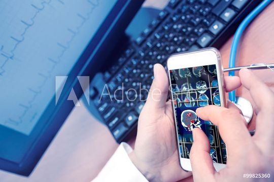 Smart Devices spielen in der Zukunft der Diagnose eine wichtige Rolle.