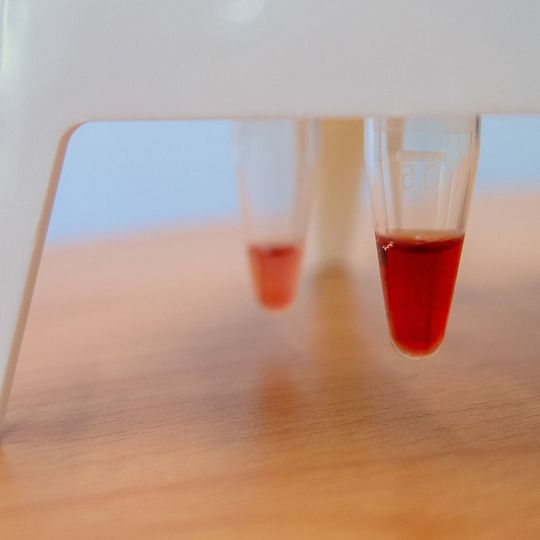 Das Bild zeigt eine Lösung von isolierter und aufgereinigter Superoxide-Oxidase, wie sie im Labor für biochemische Experimente verwendet wurde. Die charakteristische Himbeersaftfarbe erhält das Protein durch zwei sogenannte Hämgruppen, ähnlich dem Hämoglobin, welches dem Blut seinerote Farbe verleiht. Das Bild zeigt eine Lösung von isolierter und aufgereinigter Superoxide-Oxidase, wie sie im Labor für biochemische Experimente verwendet wurde. Die charakteristische Himbeersaftfarbe erhält das Protein durch zwei sogenannte Hämgruppen, ähnlich dem Hämoglobin, welches dem Blut seinerote Farbe verleiht.